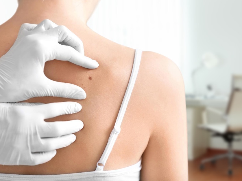 Kožní ambulance - MUDr. Zdenka Sombergová